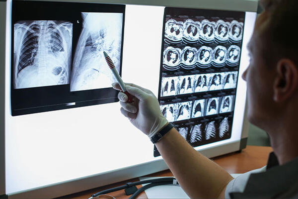 人間ドックの主な検査項目