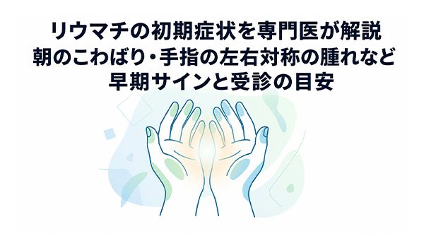 リウマチの初期症状を専門医が解説|朝のこわばり・手指の左右対称の腫れなど早期サインと受診の目安